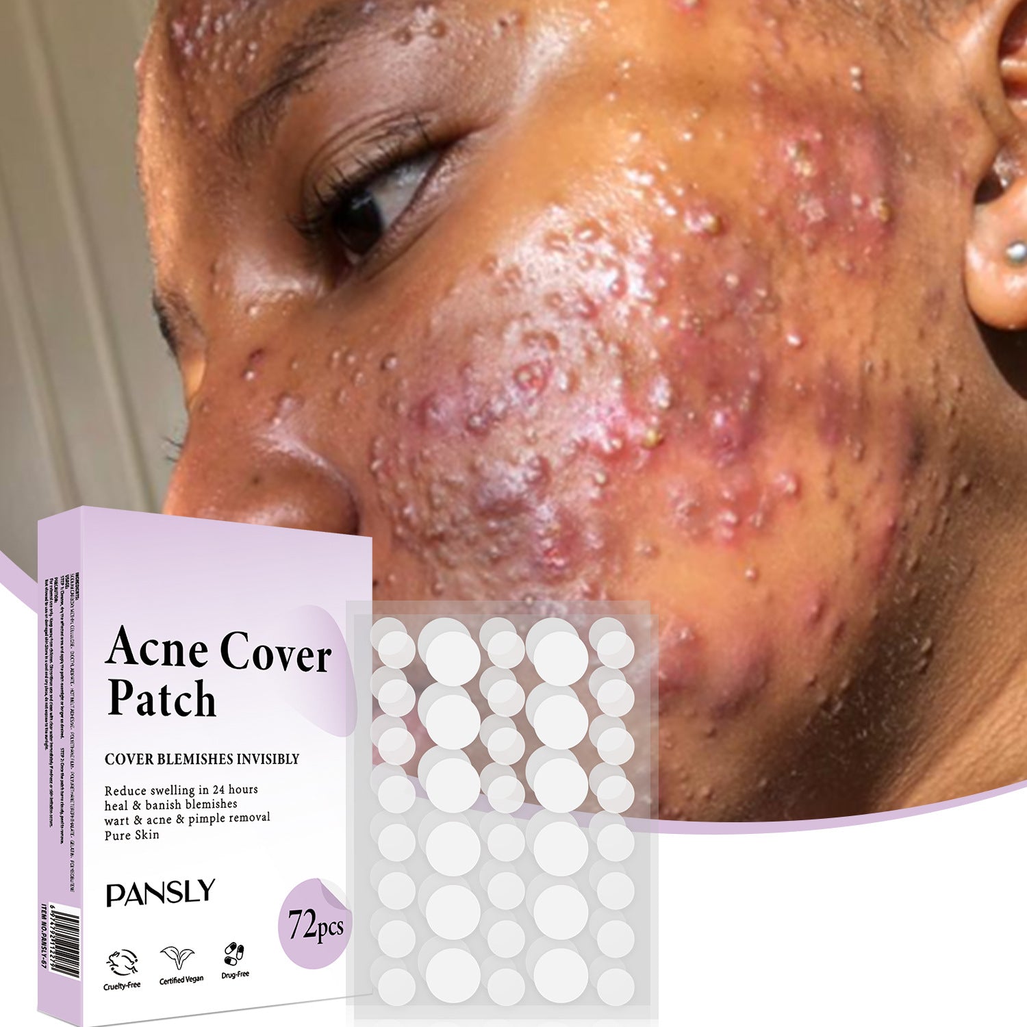 Acne Patch Skin Care - 72 Pcs